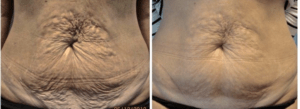 4-4-300x109