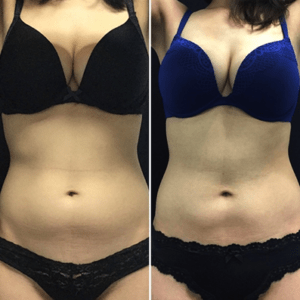 Picture1-2-300x300
