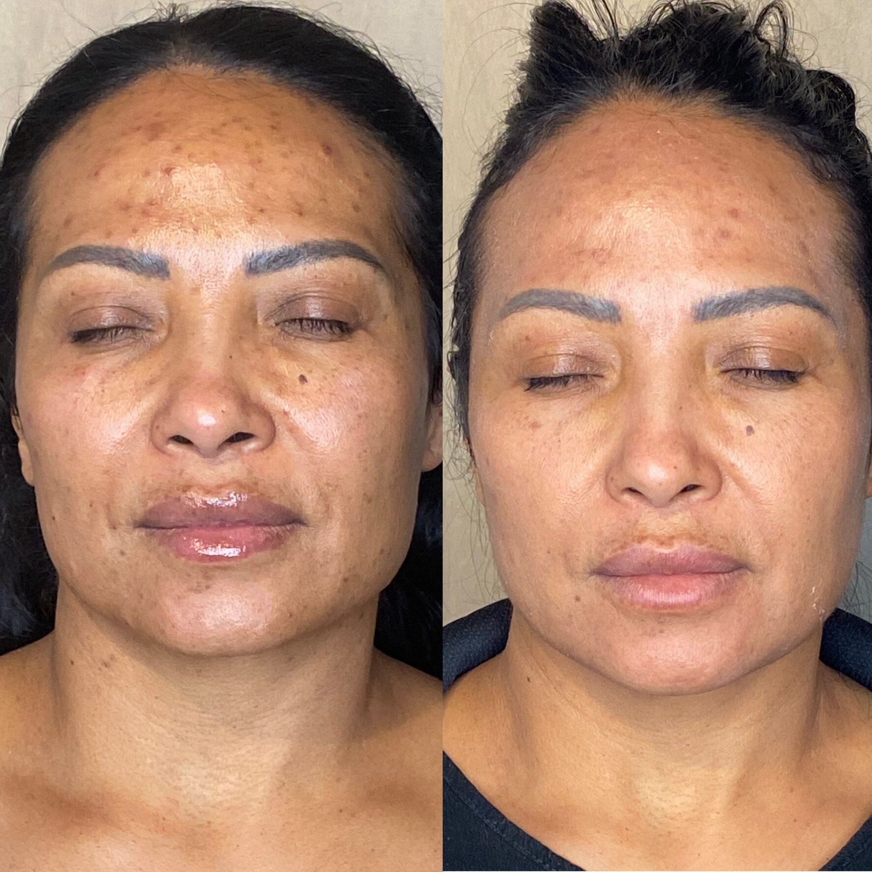 anti ageing 2